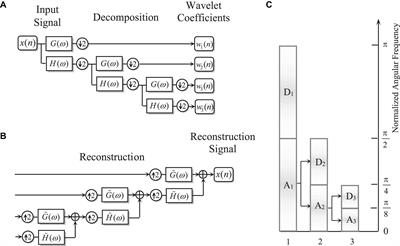 Intelligent Extraction of Salient Feature From Electroencephalogram Using Redundant Discrete Wavelet Transform